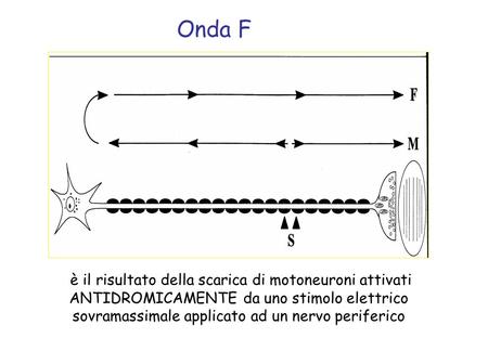 Onda F In a typical F wave study, a strong electrical stimulus is applied to the skin surface above the distal portion of a nerve so that the impulse travels.