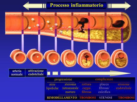 Processo infiammatorio