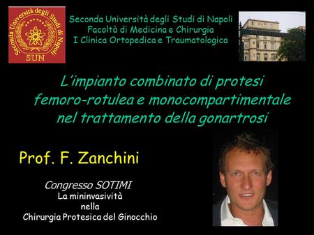 Prof. F. Zanchini L’impianto combinato di protesi