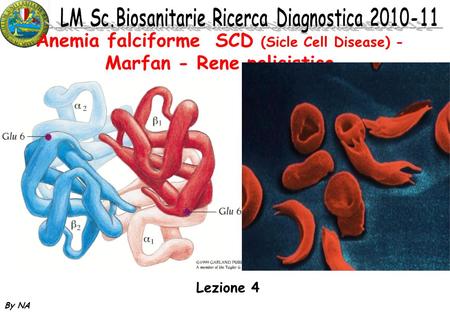 Anemia falciforme SCD (Sicle Cell Disease) - Marfan - Rene policistico