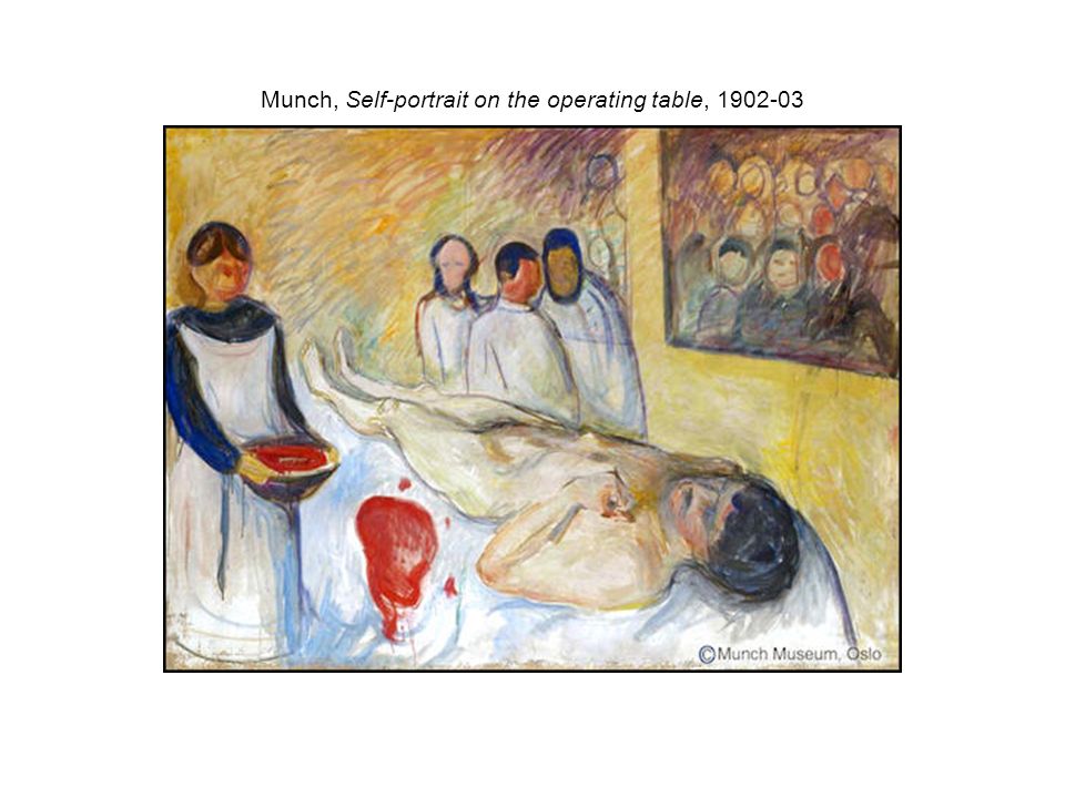 Munch, Self-portrait on the operating table,