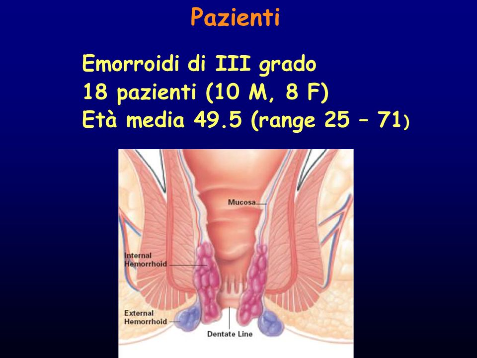 Pazienti Emorroidi di III grado 18 pazienti (10 M, 8 F)