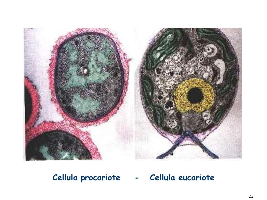 Cellula procariote - Cellula eucariote
