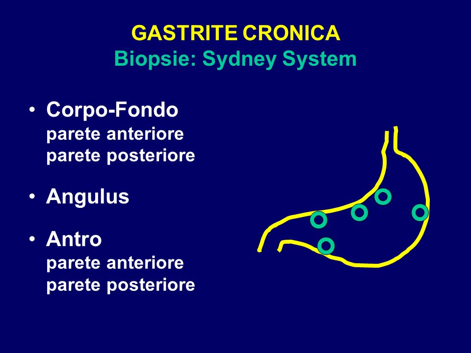 GASTRITE CRONICA Biopsie: Sydney System