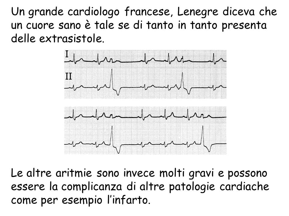 Un grande cardiologo francese, Lenegre diceva che un cuore sano è tale se di tanto in tanto presenta delle extrasistole.