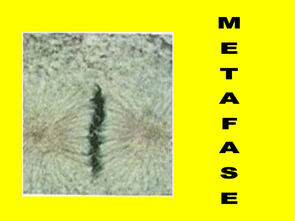METAFASE