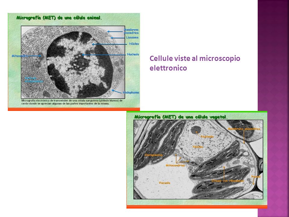 Cellule viste al microscopio elettronico