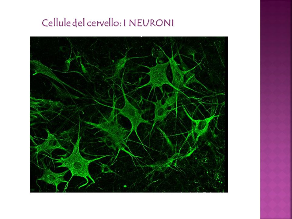 Cellule del cervello: I NEURONI