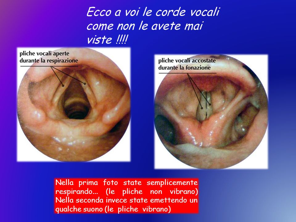 Ecco a voi le corde vocali come non le avete mai viste !!!!