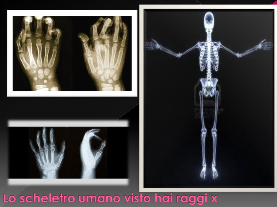 Lo scheletro umano visto hai raggi x