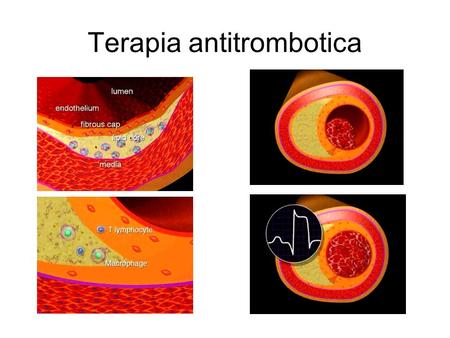 Terapia antitrombotica