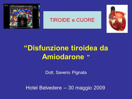 “Disfunzione tiroidea da Amiodarone ” Dott. Saverio Pignata