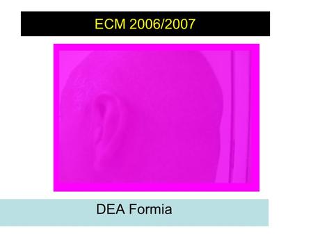 ECM 2006/2007 Non c’è turno in cui non si affronti il dilemma di cosa fare con il paziente che ha subito un trauma cranico lieve DEA Formia.