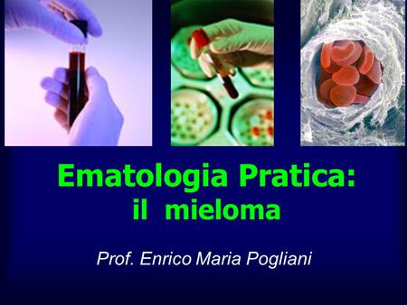 Ematologia Pratica: il mieloma