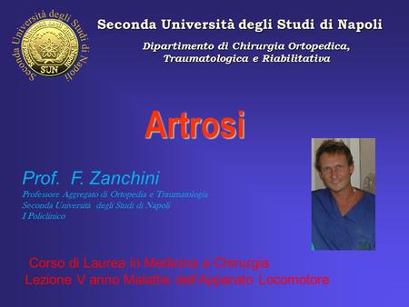 Artrosi Prof. F. Zanchini Seconda Università degli Studi di Napoli