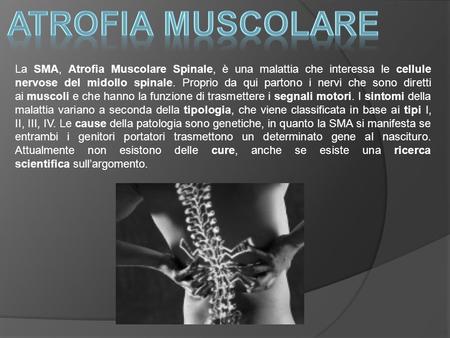 Atrofia muscolare La SMA, Atrofia Muscolare Spinale, è una malattia che interessa le cellule nervose del midollo spinale. Proprio da qui partono i nervi.