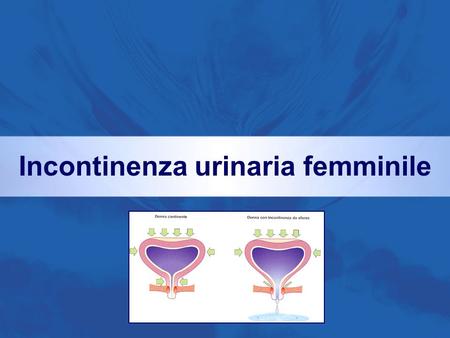 Incontinenza urinaria femminile