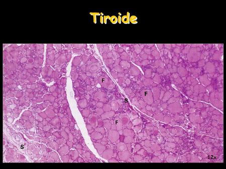 Tiroide 12x.