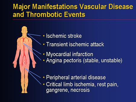 Vascular disease is the result of a generalized process that affects multiple vascular beds, including the cerebral, coronary, and peripheral arteries.