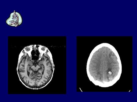 Tecniche di indagine morfologica: MRI TC. Tecniche di immagine in neurologia MorfologicheBiochimicheFunzionali Tomografia in risonanza diretta Magnetica.