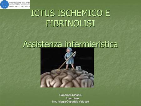 ICTUS ISCHEMICO E FIBRINOLISI Assistenza infermieristica