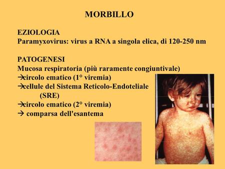 MORBILLO EZIOLOGIA Paramyxovirus: virus a RNA a singola elica, di nm
