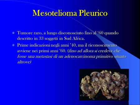 Mesotelioma Pleurico Tumore raro, a lungo disconosciuto fino al ‘60 quando descritto in 33 soggetti in Sud Africa. Prime indicazioni negli anni ’40, ma.