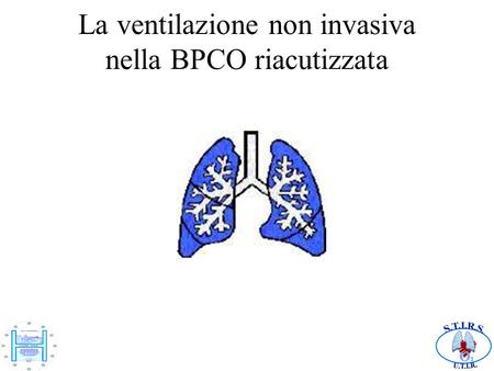 La ventilazione non invasiva nella BPCO riacutizzata