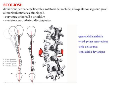 SCOLIOSI: deviazione permanente laterale e rotatoria del rachide, alla quale conseguono gravi alterazioni estetiche e funzionali. - curvature principali.
