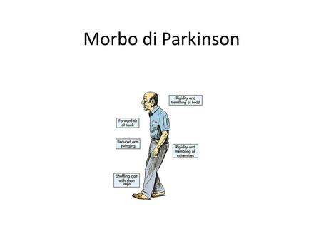 Morbo di Parkinson.