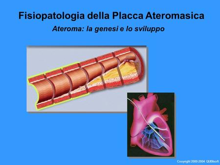 Fisiopatologia della Placca Ateromasica