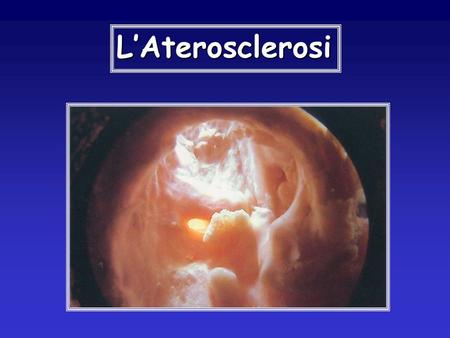 L’Aterosclerosi.