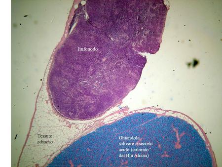 linfonodo Tessuto adiposo