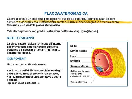 SVILUPPO DELL’ATEROSCLEROSI