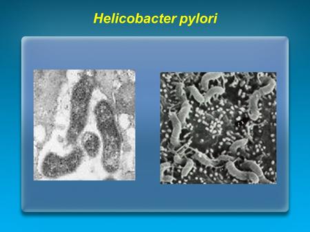 Helicobacter pylori. Il fattore patogenetico principale dell’ulcera gastrica e duodenale è come noto costituito dall’Hp. Organismo Gram–negativo costituisce.
