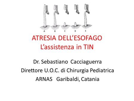 ATRESIA DELL’ESOFAGO L’assistenza in TIN Dr. Sebastiano Cacciaguerra Direttore U.O.C. di Chirurgia Pediatrica ARNAS Garibaldi, Catania.