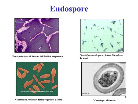 Endospore Microscopia elettronica