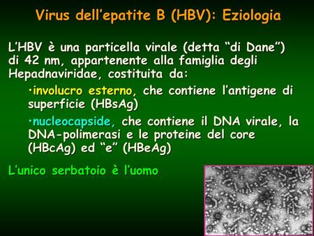 Virus dell’epatite B (HBV): Eziologia L’HBV è una particella virale (detta “di Dane”) di 42 nm, appartenente alla famiglia degli Hepadnaviridae, costituita.