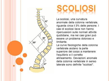 Scoliosi La scoliosi, una curvatura anormale della colonna vertebrale, riguarda circa il 3% delle persone. I casi di scoliosi lieve non hanno ripercussioni.