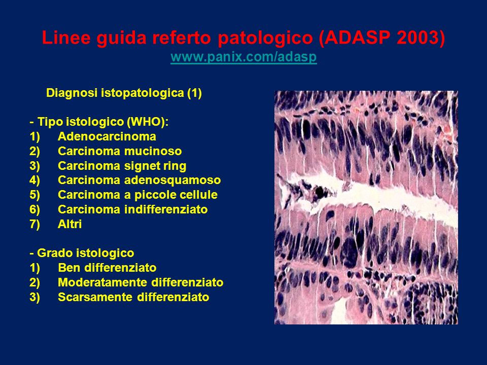 Cosa significa adenocarcinoma moderatamente differenziato