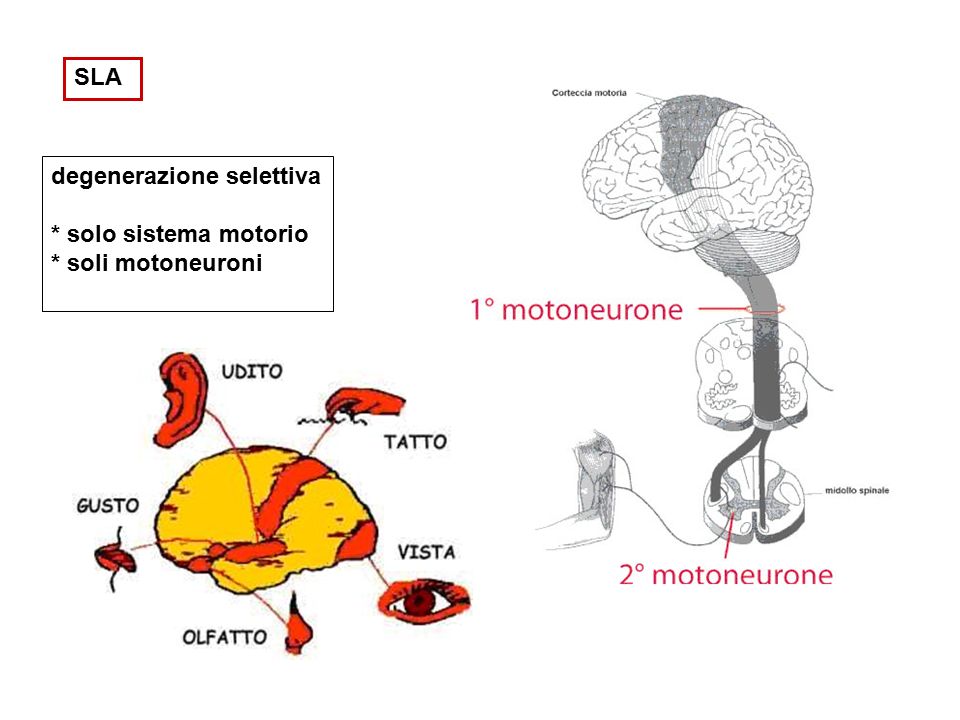 SLA degenerazione selettiva * solo sistema motorio * soli motoneuroni