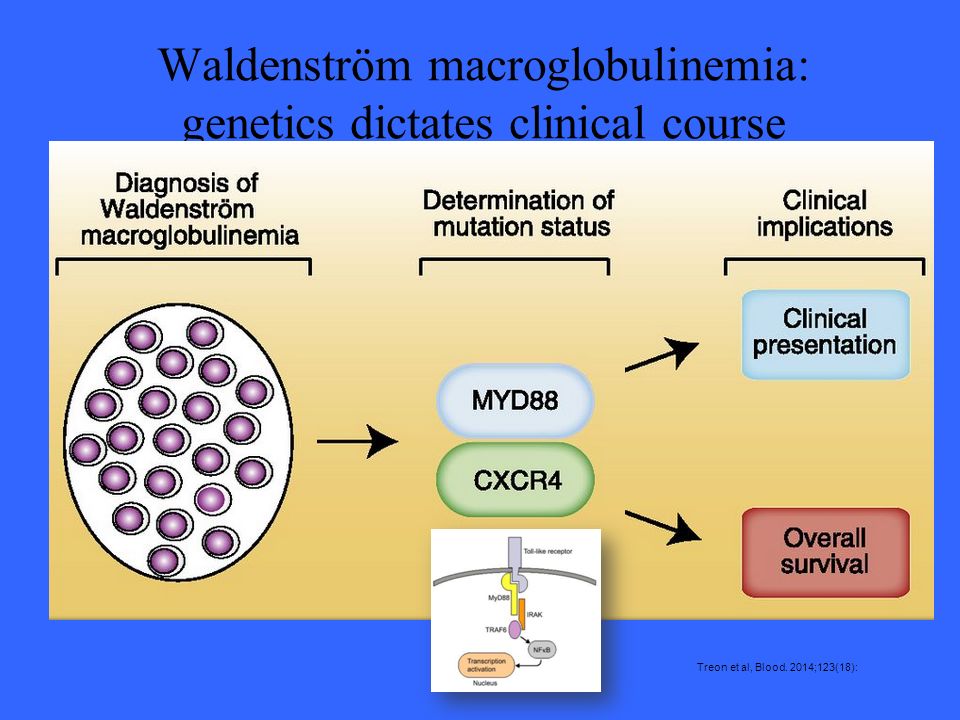 Waldenström macroglobulinemia: genetics dictates clinical course