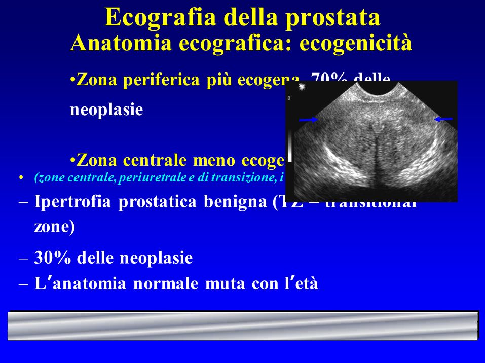 valori normale prostata ecografie)