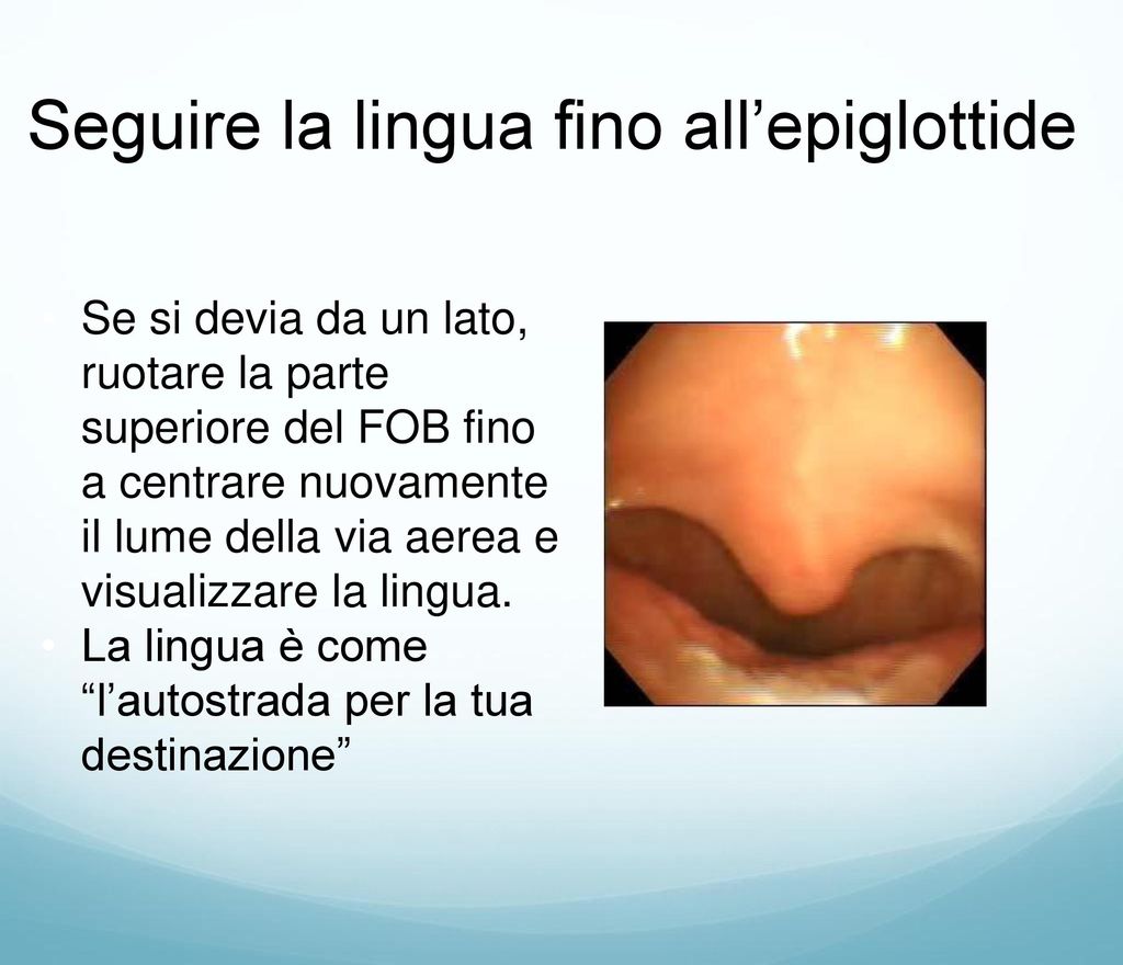 Seguire la lingua fino all’epiglottide