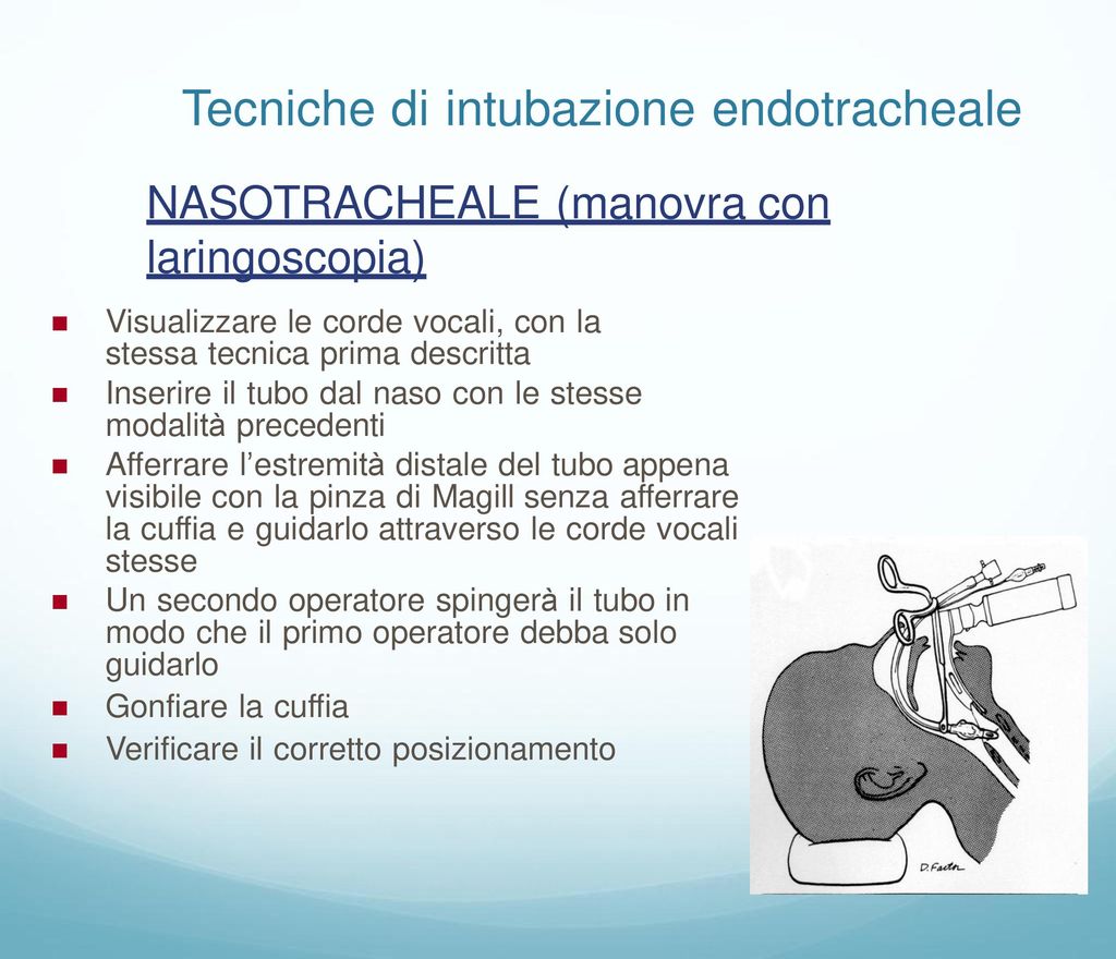 Tecniche di intubazione endotracheale