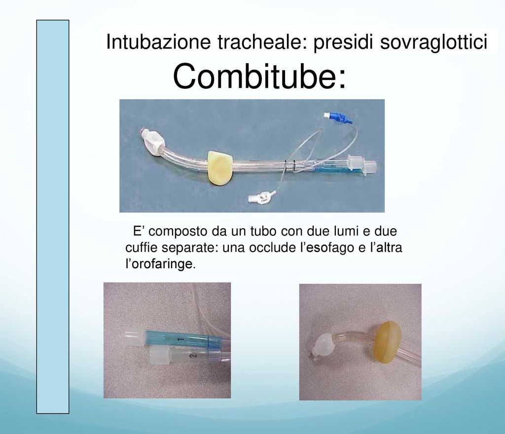 Combitube: Intubazione tracheale: presidi sovraglottici