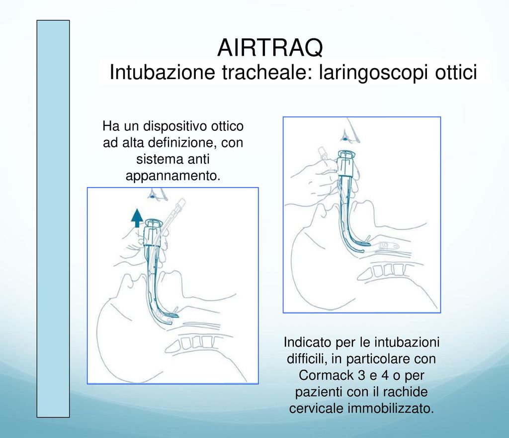 AIRTRAQ Intubazione tracheale: laringoscopi ottici