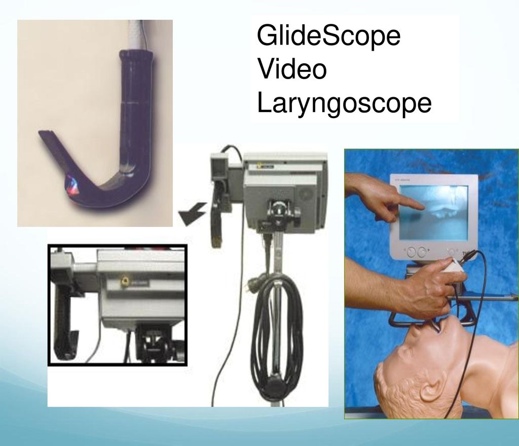 GlideScope Video Laryngoscope