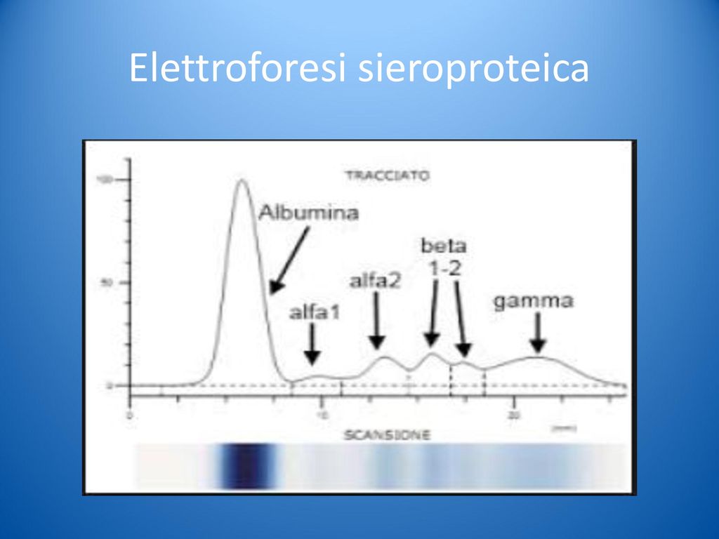 Elettroforesi sieroproteica
