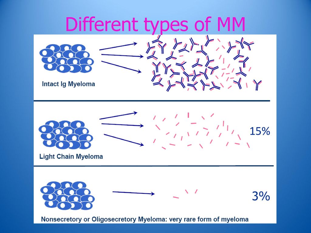 Different types of MM 15% 3% 21